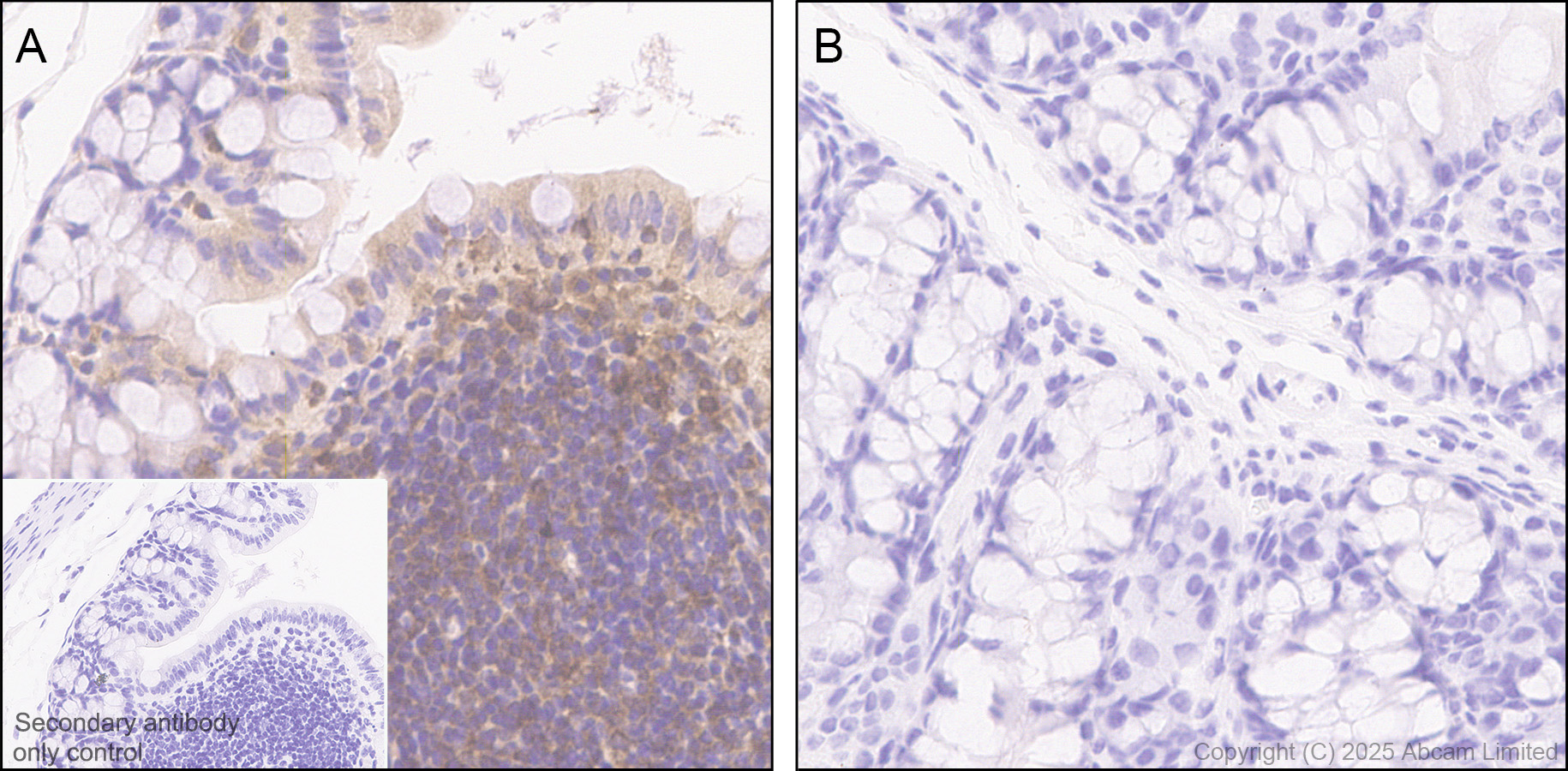 Immunohistochemistry (Formalin/PFA-fixed paraffin-embedded sections) - Anti-STAT1 alpha antibody [EPYR2154] (AB92506)