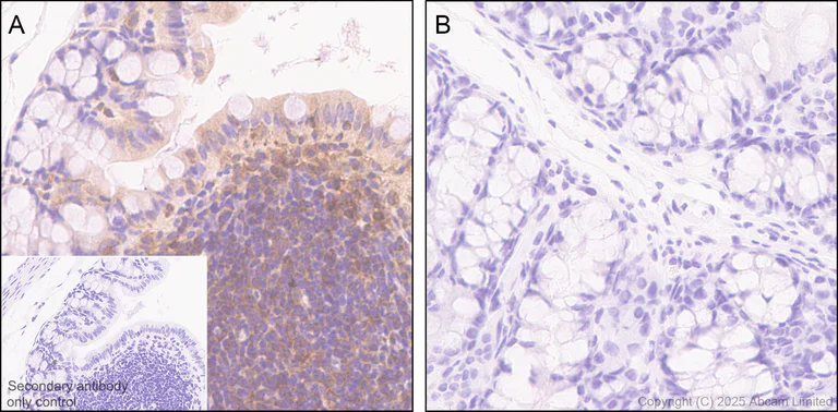 Immunohistochemistry (Formalin/PFA-fixed paraffin-embedded sections) - Anti-STAT1 alpha antibody [EPYR2154] (AB92506)