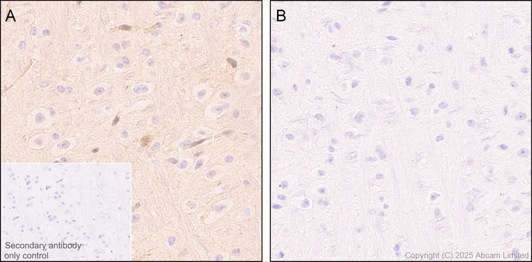 Immunohistochemistry (Formalin/PFA-fixed paraffin-embedded sections) - Anti-STAT1 alpha antibody [EPYR2154] (AB92506)