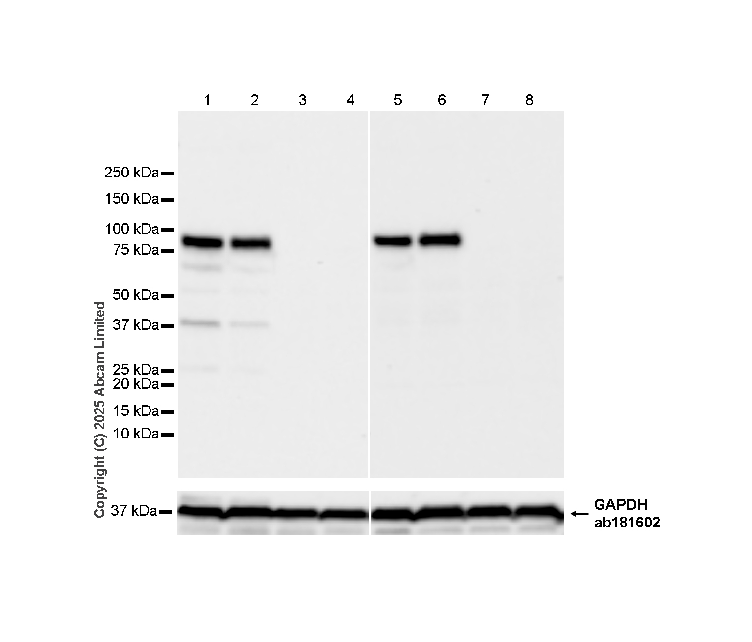 Anti-STAT1 alpha antibody [EPYR2154]