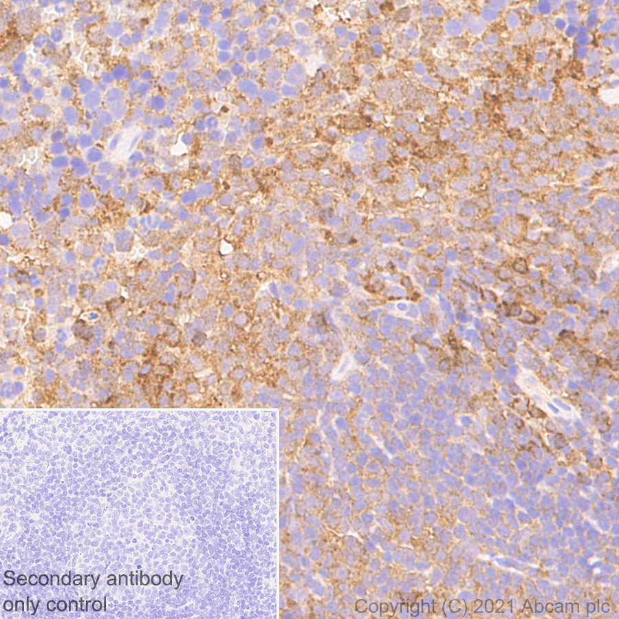 Immunohistochemistry (Formalin/PFA-fixed paraffin-embedded sections) - Anti-STAT1 antibody [1/Stat1] - BSA and Azide free (AB282026), expandable thumbnail