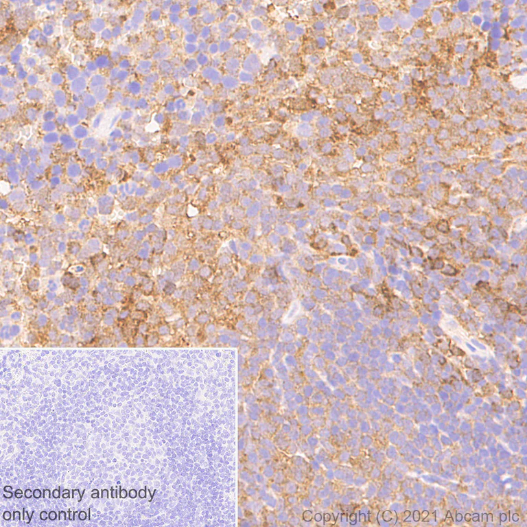 Immunohistochemistry (Formalin/PFA-fixed paraffin-embedded sections) - Anti-STAT1 antibody [1/Stat1] - BSA and Azide free (AB282026)