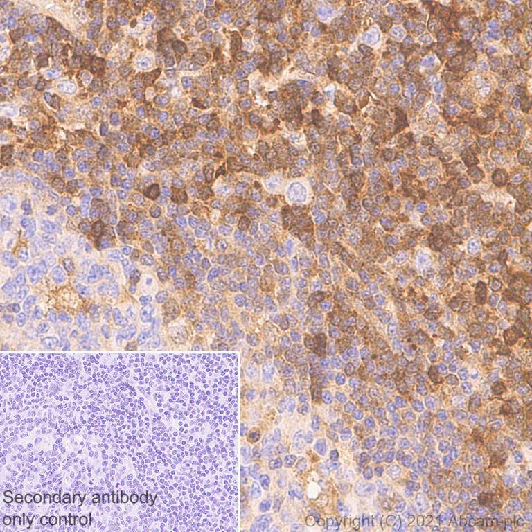 Immunohistochemistry (Formalin/PFA-fixed paraffin-embedded sections) - Anti-STAT1 antibody [1/Stat1] - BSA and Azide free (AB282026)