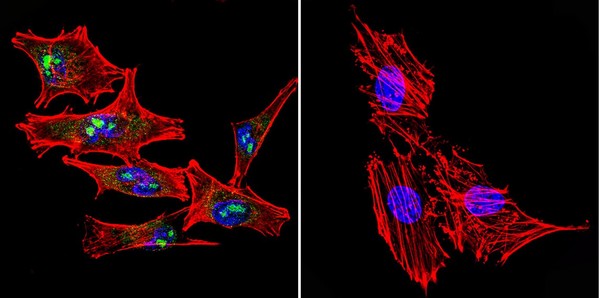 Immunocytochemistry/ Immunofluorescence - Anti-STAT1 antibody [15H3] (AB155933), expandable thumbnail