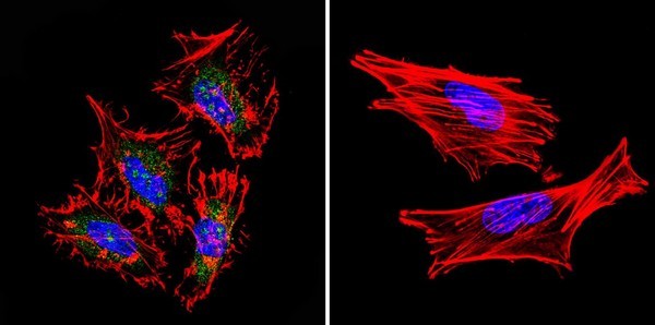 Immunocytochemistry/ Immunofluorescence - Anti-STAT1 antibody [15H3] (AB155933), expandable thumbnail