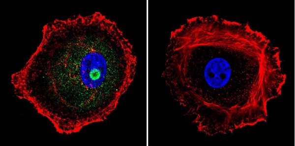 Immunocytochemistry/ Immunofluorescence - Anti-STAT1 antibody [15H3] (AB155933), expandable thumbnail