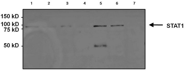 Western blot - Anti-STAT1 antibody [15H3] (AB155933), expandable thumbnail