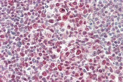 Immunohistochemistry (Formalin/PFA-fixed paraffin-embedded sections) - Anti-STAT1 antibody (AB230428)