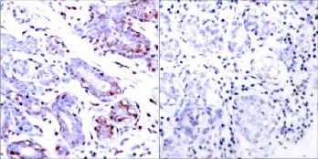 Immunohistochemistry (Formalin/PFA-fixed paraffin-embedded sections) - Anti-STAT1 antibody (AB31369)