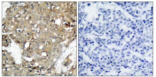 Immunohistochemistry (Formalin/PFA-fixed paraffin-embedded sections) - Anti-STAT1 antibody (AB47425)