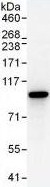 Immunoprecipitation - Anti-STAT1 antibody (AB99415), expandable thumbnail