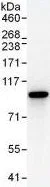 Immunoprecipitation - Anti-STAT1 antibody (AB99415)