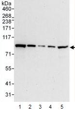 Western blot - Anti-STAT1 antibody (AB99415), expandable thumbnail