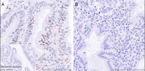 Immunohistochemistry (Formalin/PFA-fixed paraffin-embedded sections) - Anti-STAT1 antibody [EPR21057-141] - BSA and Azide free (AB234904)