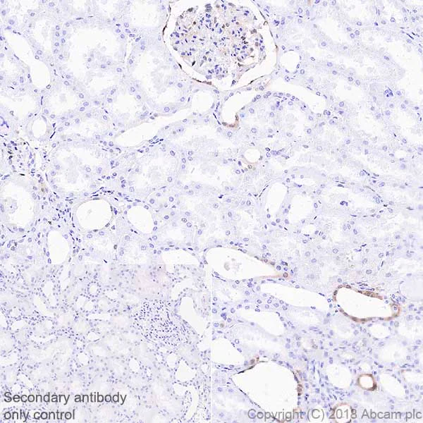 Immunohistochemistry (Formalin/PFA-fixed paraffin-embedded sections) - Anti-STAT1 antibody [EPR21057-141] - ChIP Grade (AB234400)