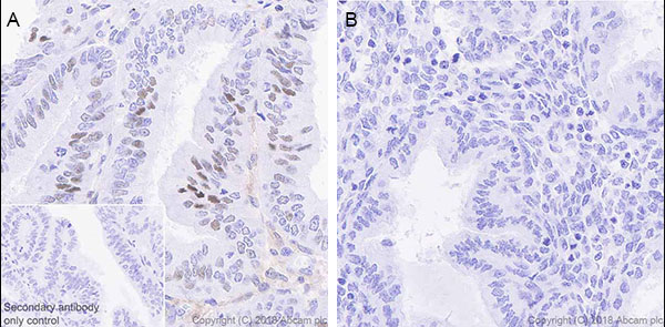 Immunohistochemistry (Formalin/PFA-fixed paraffin-embedded sections) - Anti-STAT1 antibody [EPR21057-141] - ChIP Grade (ab234400), expandable thumbnail