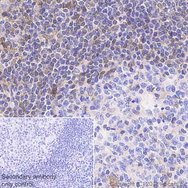 Immunohistochemistry (Formalin/PFA-fixed paraffin-embedded sections) - Anti-STAT1 antibody [EPR21057-141] - ChIP Grade (AB234400), expandable thumbnail