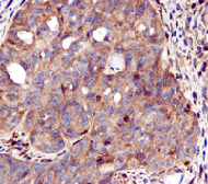 Immunohistochemistry (Formalin/PFA-fixed paraffin-embedded sections) - Anti-STAT1 antibody [EPR4407] (ab109320), expandable thumbnail