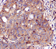Immunohistochemistry (Formalin/PFA-fixed paraffin-embedded sections) - Anti-STAT1 antibody [EPR4407] - BSA and Azide free (AB239968)
