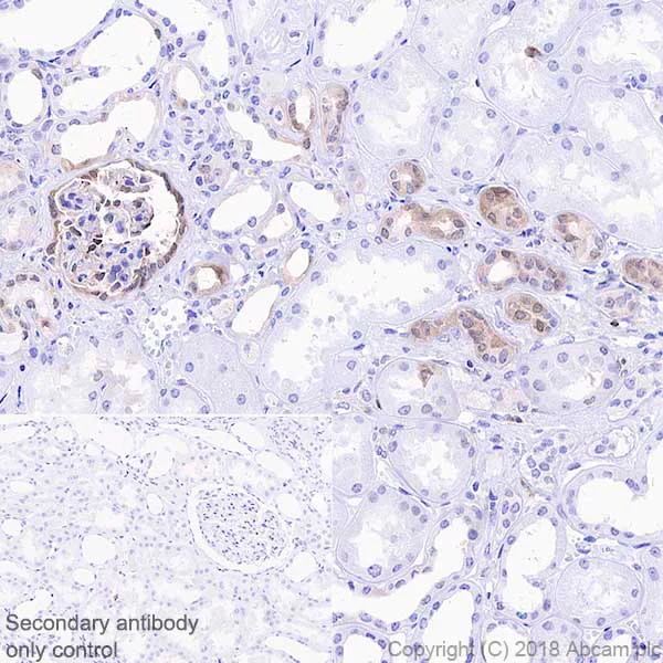 Immunohistochemistry (Formalin/PFA-fixed paraffin-embedded sections) - Anti-STAT1 antibody [EPRR21057-168] - BSA and Azide free (AB234902)