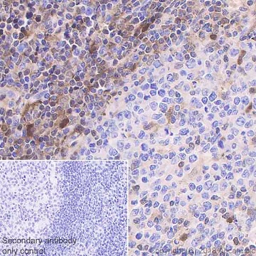 Immunohistochemistry (Formalin/PFA-fixed paraffin-embedded sections) - Anti-STAT1 antibody [EPRR21057-168] - BSA and Azide free (AB234902)