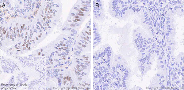 Immunohistochemistry (Formalin/PFA-fixed paraffin-embedded sections) - Anti-STAT1 antibody [EPRR21057-168] - BSA and Azide free (AB234902)