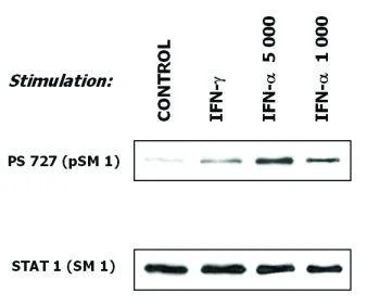 Western blot - Anti-STAT1 antibody [SM1] (AB3987)