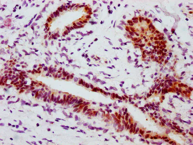 Immunohistochemistry (Formalin/PFA-fixed paraffin-embedded sections) - Anti-STAT1 (phospho S727) antibody [2H10] (AB314033)