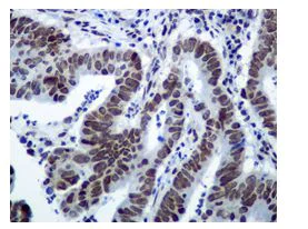 Immunohistochemistry (Formalin/PFA-fixed paraffin-embedded sections) - Anti-STAT1 (phospho S727) antibody [EPR3146] (AB109461)