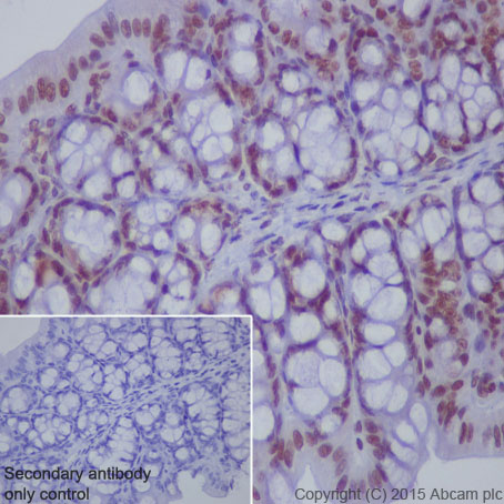 Immunohistochemistry (Formalin/PFA-fixed paraffin-embedded sections) - Anti-STAT1 (phospho S727) antibody [EPR3146] (AB109461), expandable thumbnail