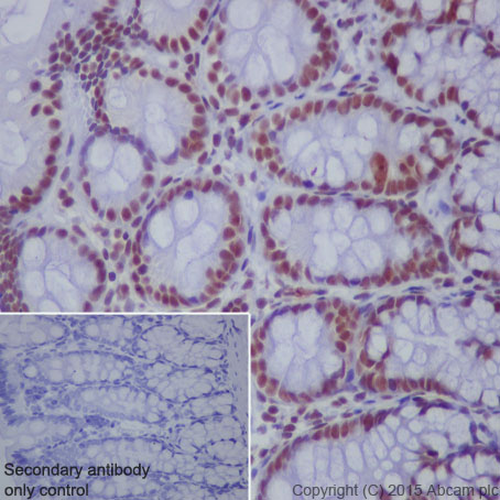 Immunohistochemistry (Formalin/PFA-fixed paraffin-embedded sections) - Anti-STAT1 (phospho S727) antibody [EPR3146] (AB109461), expandable thumbnail