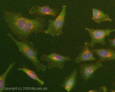 Immunocytochemistry/ Immunofluorescence - Anti-STAT1 (phospho Y701) antibody (AB30645)