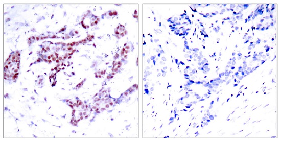 Immunohistochemistry (Formalin/PFA-fixed paraffin-embedded sections) - Anti-STAT1 (phospho Y701) antibody (AB30645), expandable thumbnail