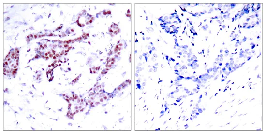 Immunohistochemistry (Formalin/PFA-fixed paraffin-embedded sections) - Anti-STAT1 (phospho Y701) antibody (AB30645)