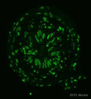 Immunohistochemistry (Formalin/PFA-fixed paraffin-embedded sections) - Anti-STAT1 (phospho Y701) antibody (AB30645), expandable thumbnail