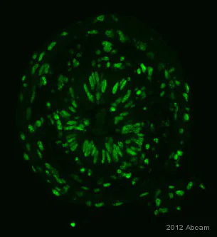 Immunohistochemistry (Formalin/PFA-fixed paraffin-embedded sections) - Anti-STAT1 (phospho Y701) antibody (AB30645)