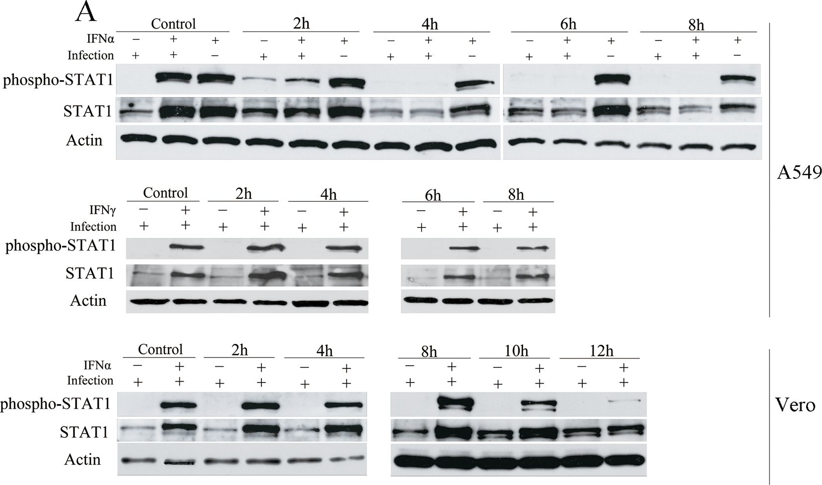 Western blot - Anti-STAT1 (phospho Y701) antibody (AB30645), expandable thumbnail