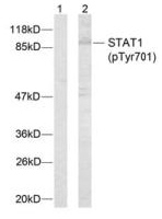 Western blot - Anti-STAT1 (phospho Y701) antibody (AB30645), expandable thumbnail
