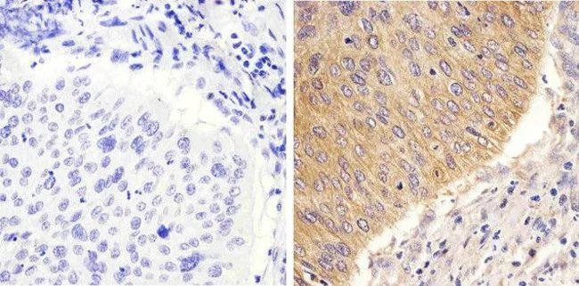 Immunohistochemistry (Formalin/PFA-fixed paraffin-embedded sections) - Anti-STAT2 antibody [1HCLC] (AB277764)