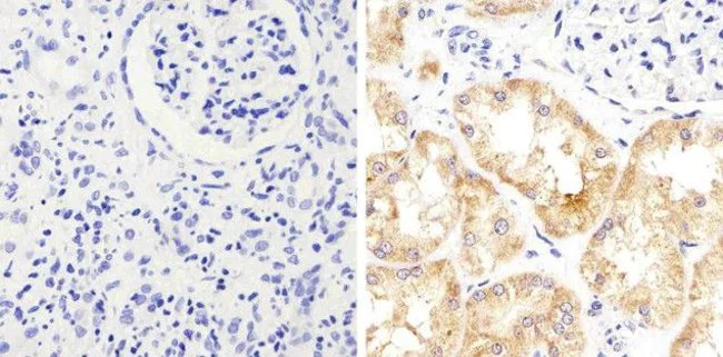 Immunohistochemistry (Formalin/PFA-fixed paraffin-embedded sections) - Anti-STAT2 antibody [1HCLC] (AB277764)