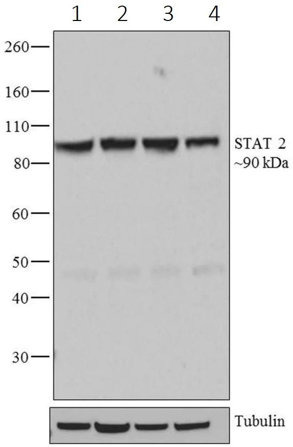 Western blot - Anti-STAT2 antibody [1HCLC] (AB277764)