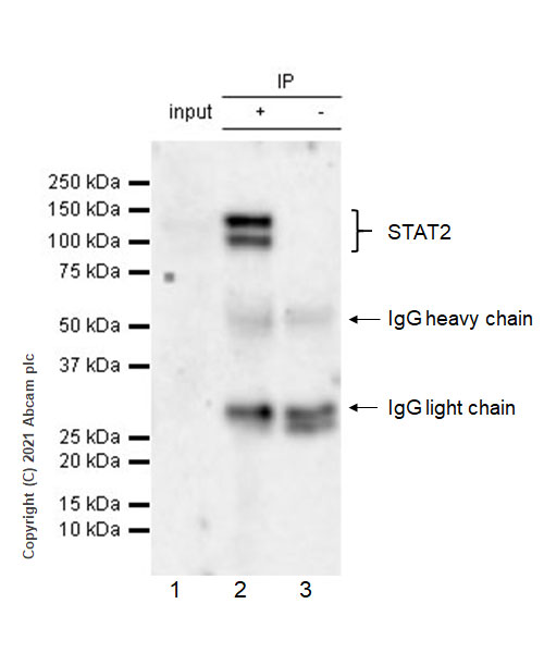 Immunoprecipitation - Anti-STAT2 antibody [22/Stat2] - BSA and Azide free (AB280904), expandable thumbnail