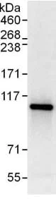 Immunoprecipitation - Anti-STAT2 antibody (AB124283)