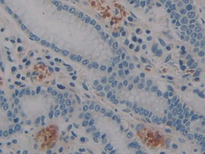 Immunohistochemistry (Formalin/PFA-fixed paraffin-embedded sections) - Anti-STAT2 antibody (AB233177)