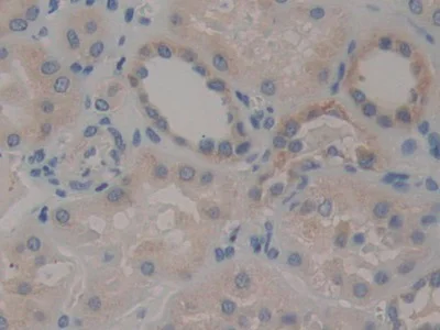 Immunohistochemistry (Formalin/PFA-fixed paraffin-embedded sections) - Anti-STAT2 antibody (AB233177)