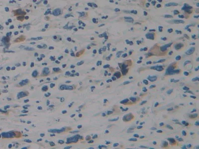 Immunohistochemistry (Formalin/PFA-fixed paraffin-embedded sections) - Anti-STAT2 antibody (AB233177)