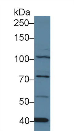 Western blot - Anti-STAT2 antibody (AB233177)