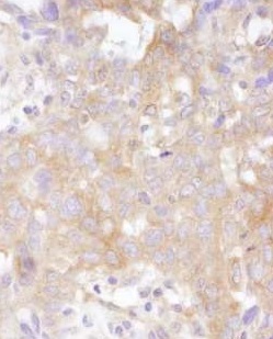 Immunohistochemistry (Formalin/PFA-fixed paraffin-embedded sections) - Anti-STAT2 antibody (AB245394)