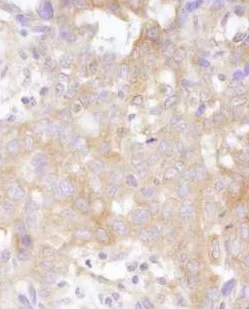Immunohistochemistry (Formalin/PFA-fixed paraffin-embedded sections) - Anti-STAT2 antibody (AB245394)
