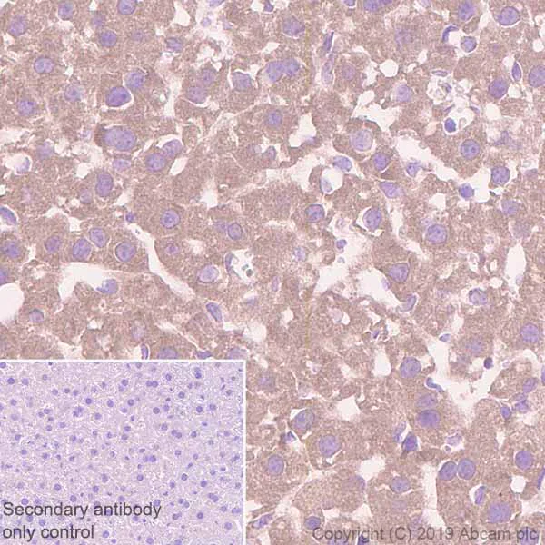 Immunohistochemistry (Formalin/PFA-fixed paraffin-embedded sections) - Anti-STAT2 antibody [Y141] (AB32367)
